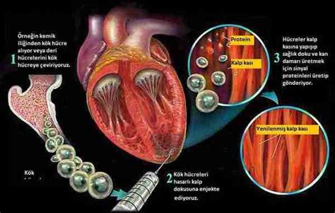 kalp sağlığı tehlikeleri cmd tr)